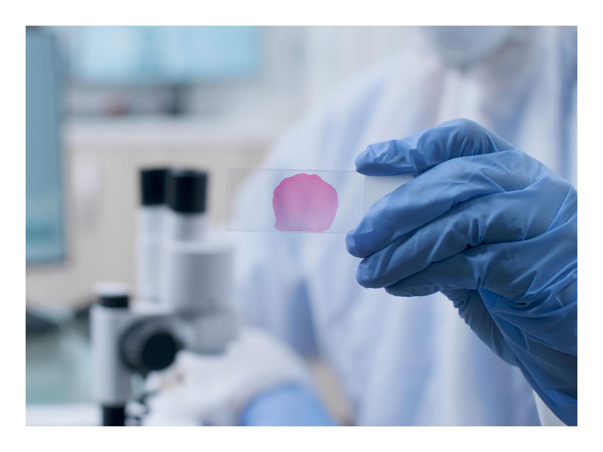 prevenzione-cancro-BLOG